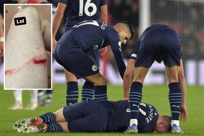 Manchester City star Aymeric Laporte shows off horror gash on thigh after being caught by Stuart Armstrong's boot